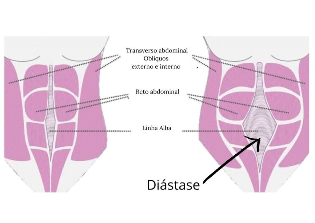 Di Stase Abdominal Health Training